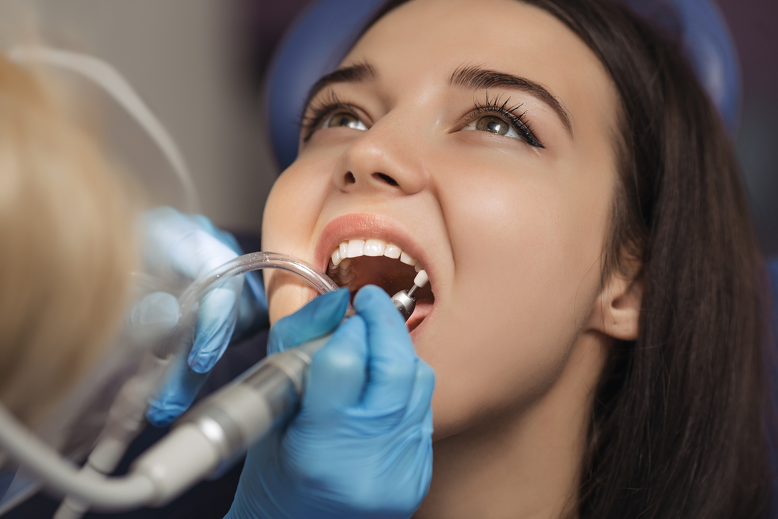 Transforming Smiles: The Revolutionary Impact of Dental Implants in Restorative Dentistry